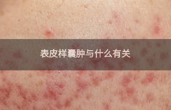 表皮样囊肿与什么有关