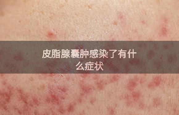 皮脂腺囊肿感染了有什么症状