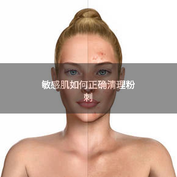 敏感肌如何正确清理粉刺