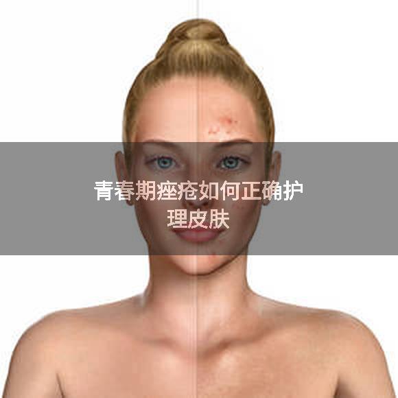 青春期痤疮如何正确护理皮肤