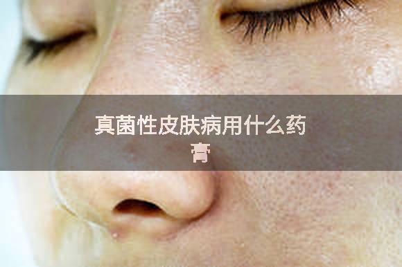 真菌性皮肤病用什么药膏