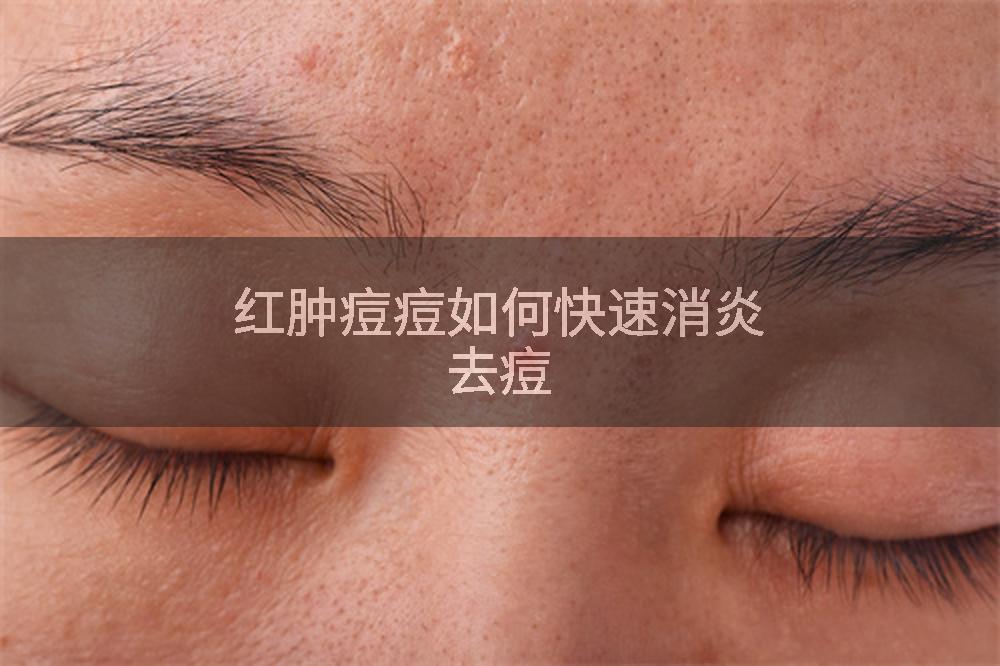 红肿痘痘如何快速消炎去痘