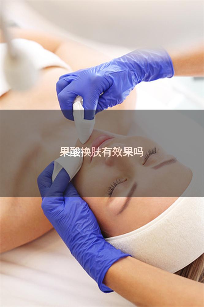 果酸换肤有效果吗