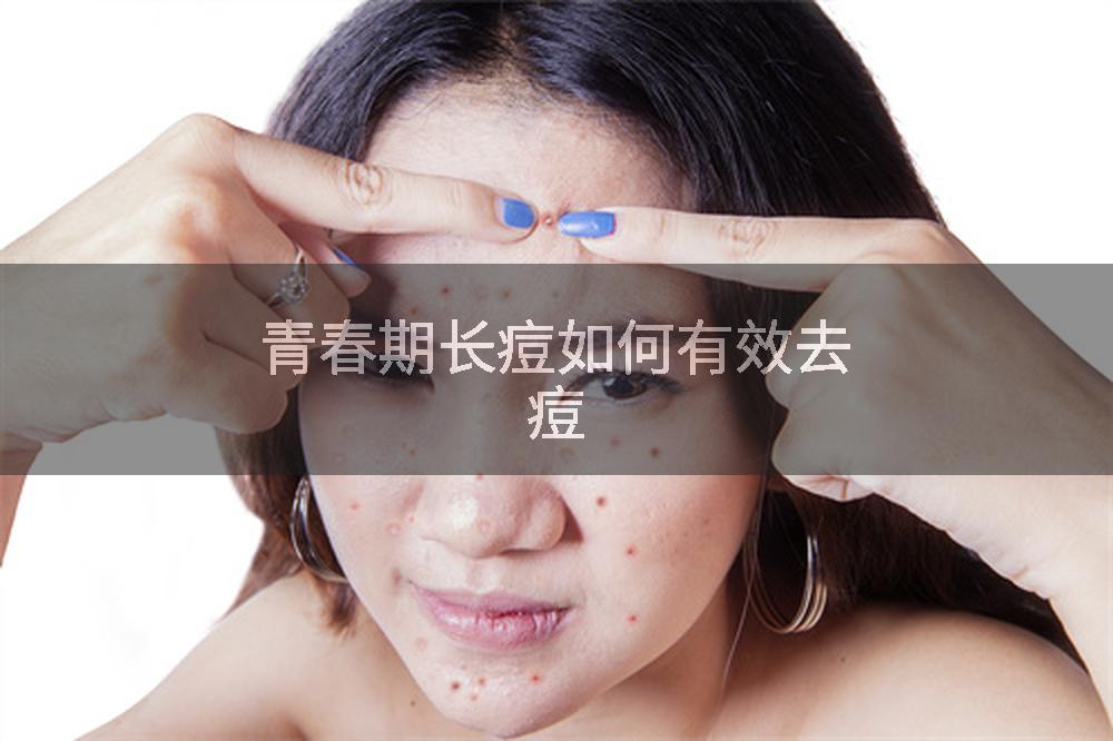 青春期长痘如何有效去痘