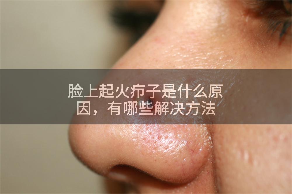 脸上起火疖子是什么原因，有哪些解决方法