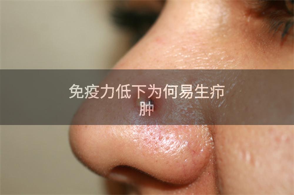 免疫力低下为何易生疖肿