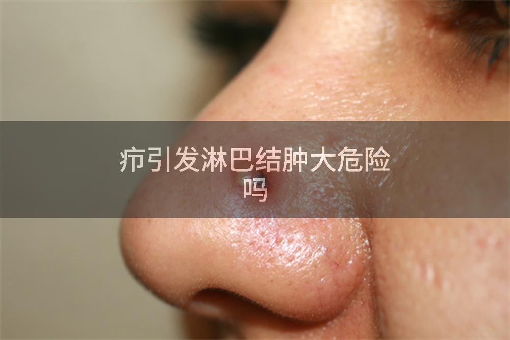 疖引发淋巴结肿大危险吗