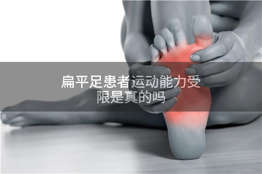 扁平足患者运动能力受限是真的吗