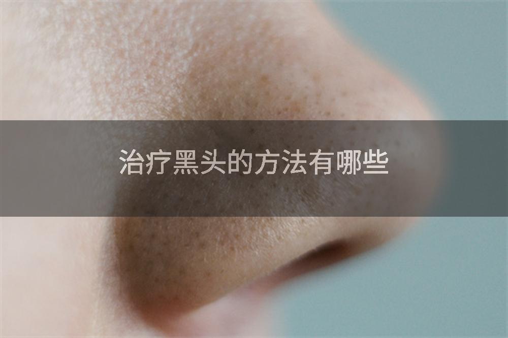 治疗黑头的方法有哪些