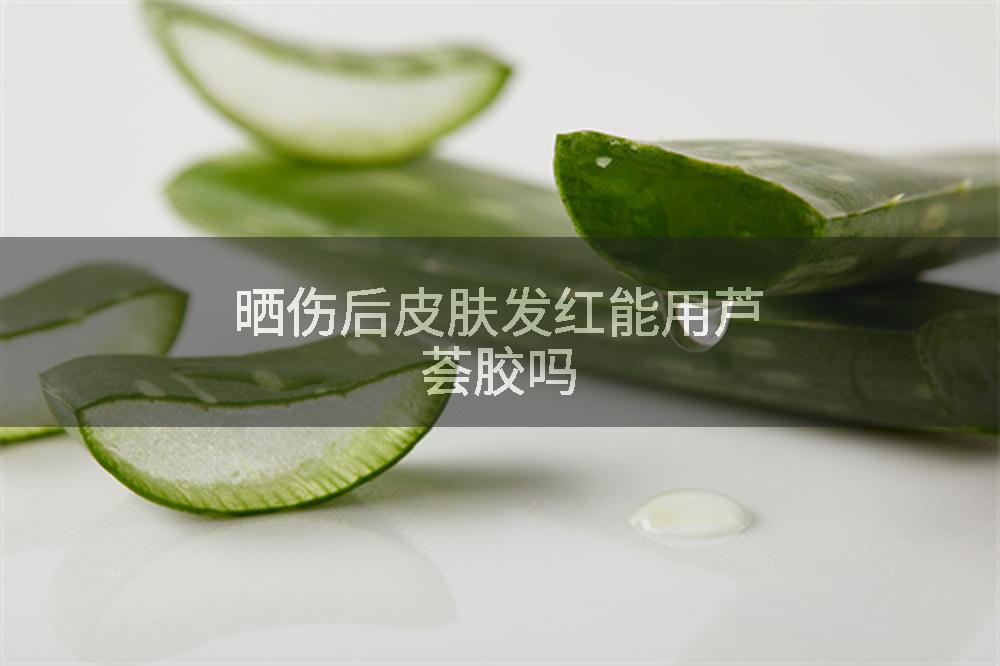 晒伤后皮肤发红能用芦荟胶吗