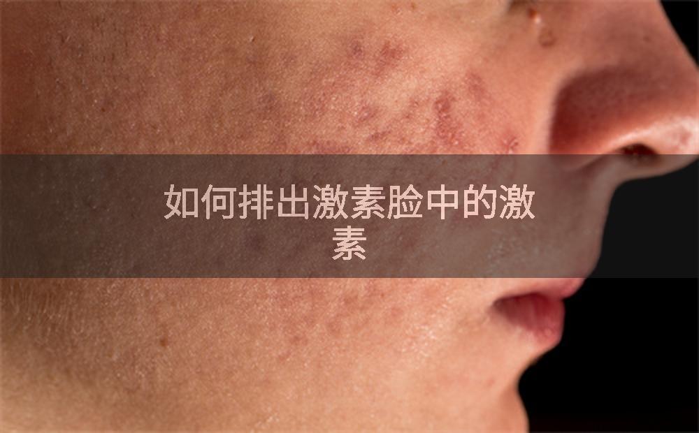 如何排出激素脸中的激素