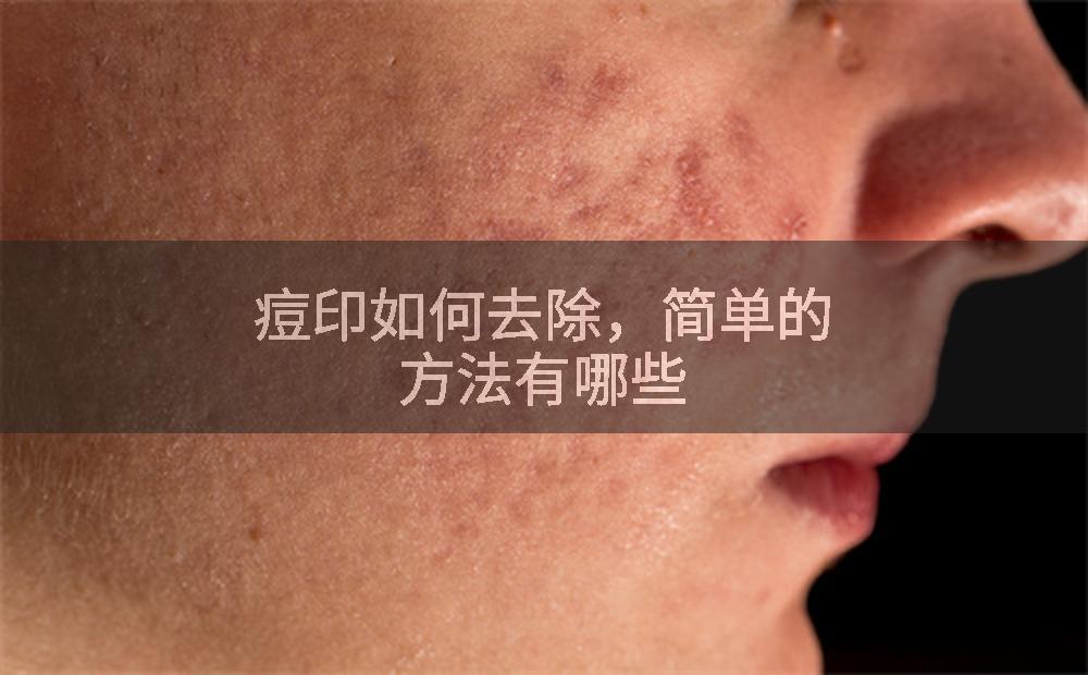 痘印如何去除，简单的方法有哪些