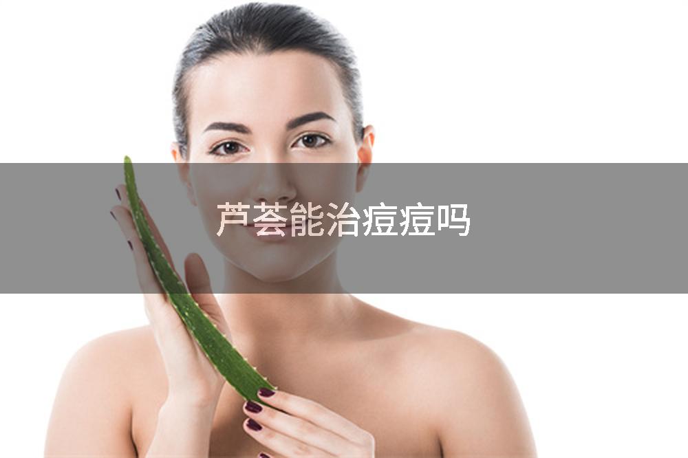 芦荟能治痘痘吗