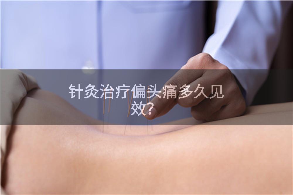 针灸治疗偏头痛多久见效?