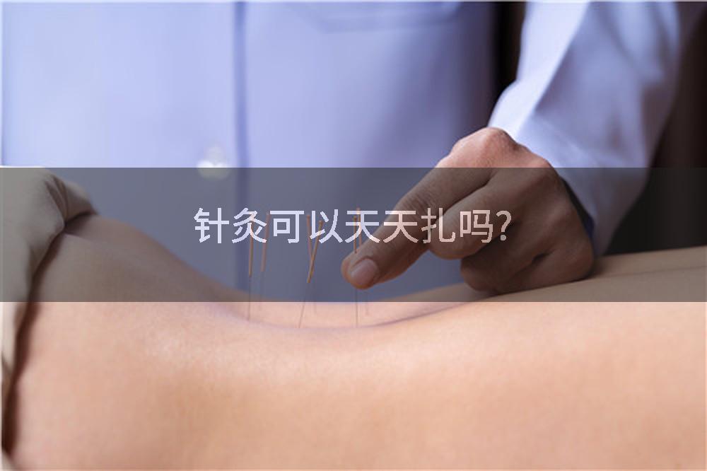 针灸可以天天扎吗?