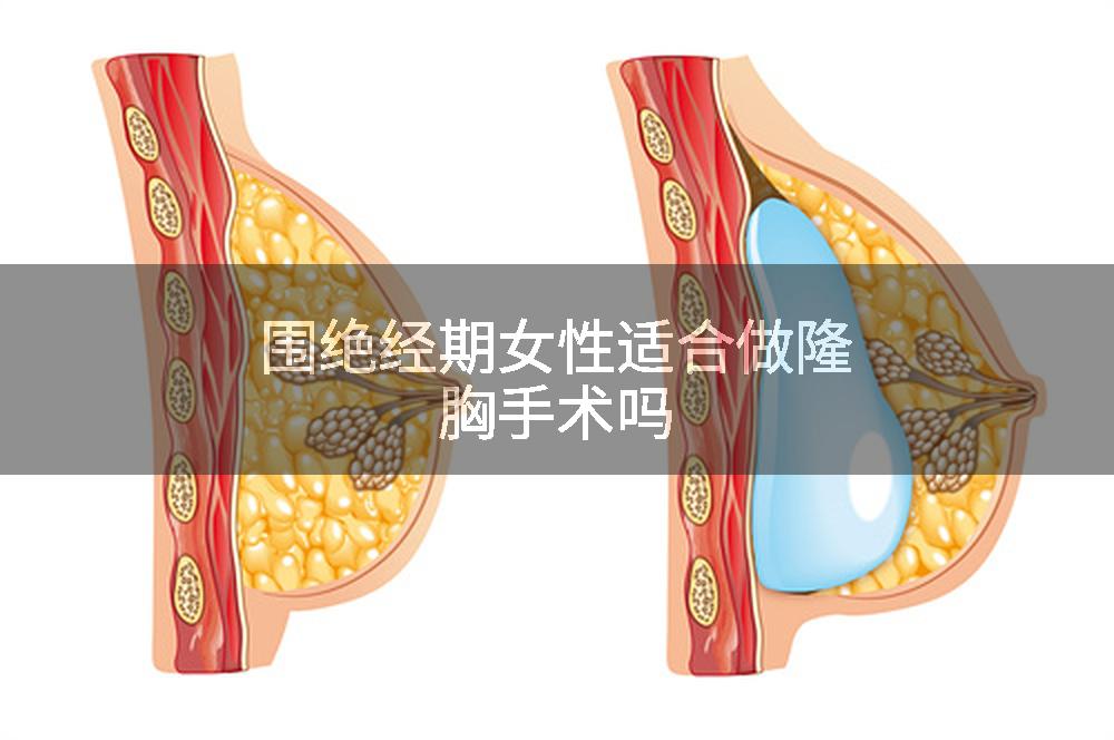 围绝经期女性适合做隆胸手术吗