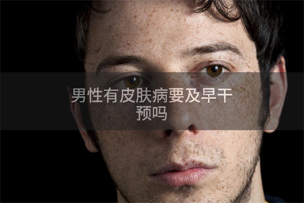 男性有皮肤病要及早干预吗