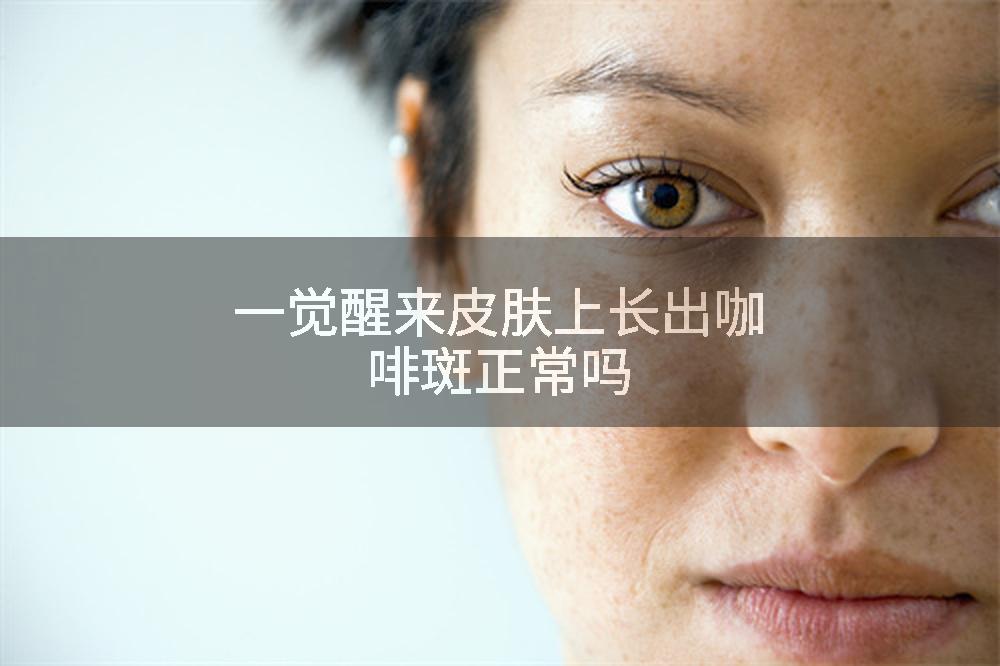 一觉醒来皮肤上长出咖啡斑正常吗