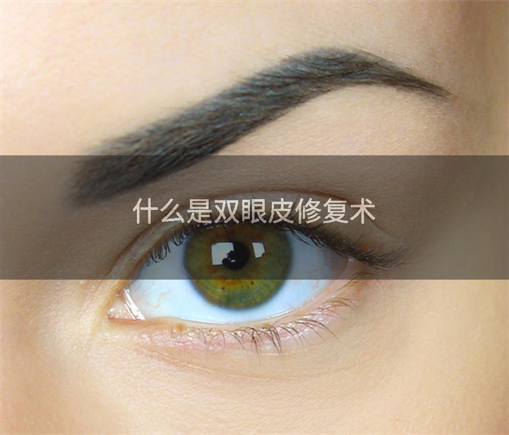 什么是双眼皮修复术