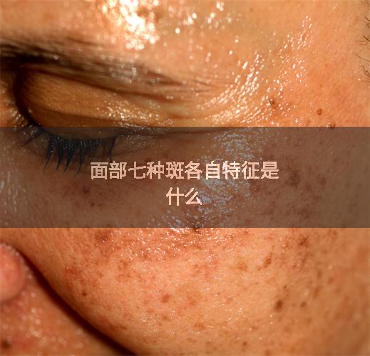 面部七种斑各自特征是什么