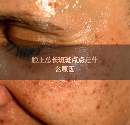 脸上总长斑斑点点是什么原因
