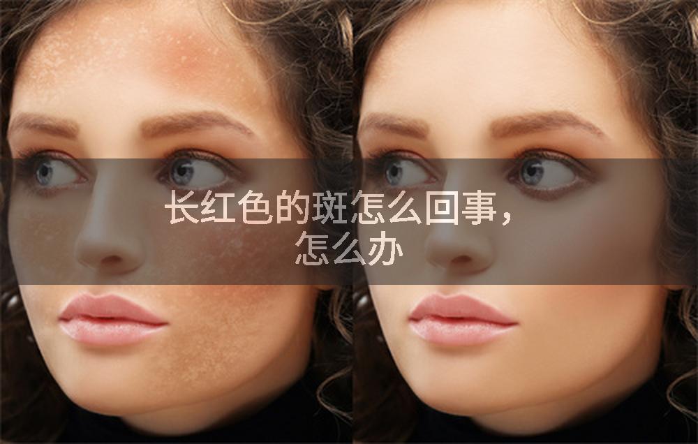 长红色的斑怎么回事，怎么办