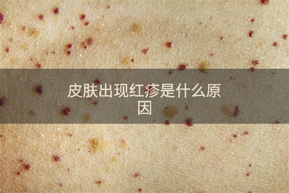 皮肤出现红疹是什么原因