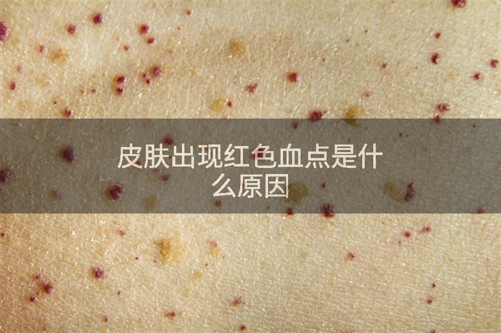 皮肤出现红色血点是什么原因