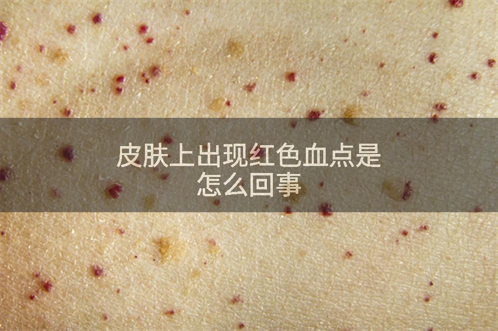 皮肤上出现红色血点是怎么回事
