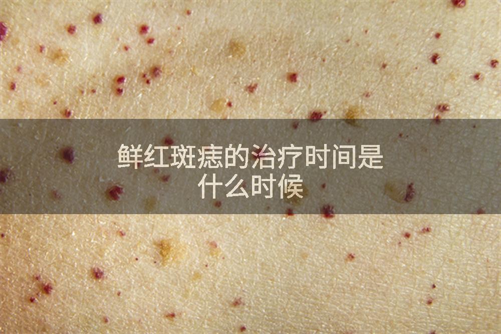 鲜红斑痣的治疗时间是什么时候