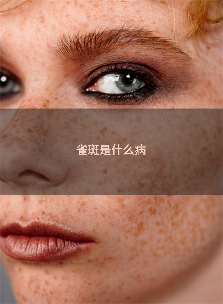 雀斑是什么病