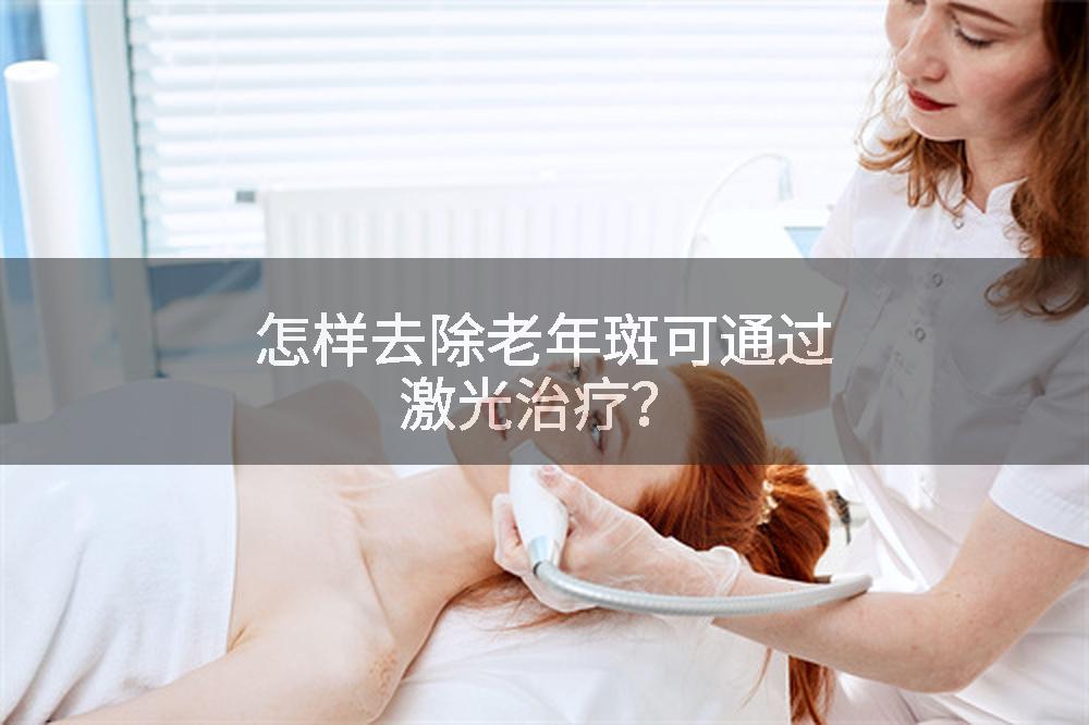 怎样去除老年斑可通过激光治疗？