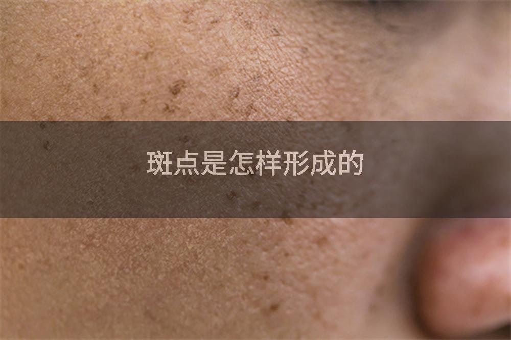 斑点是怎样形成的