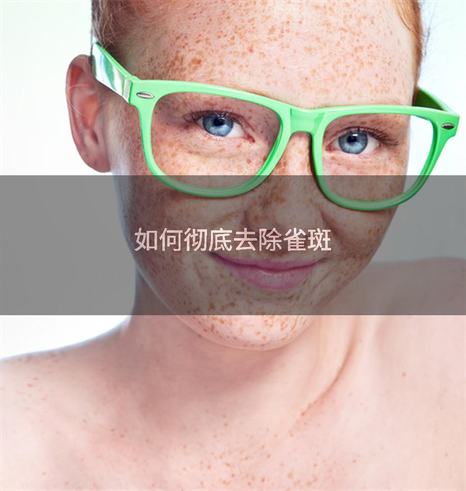如何彻底去除雀斑