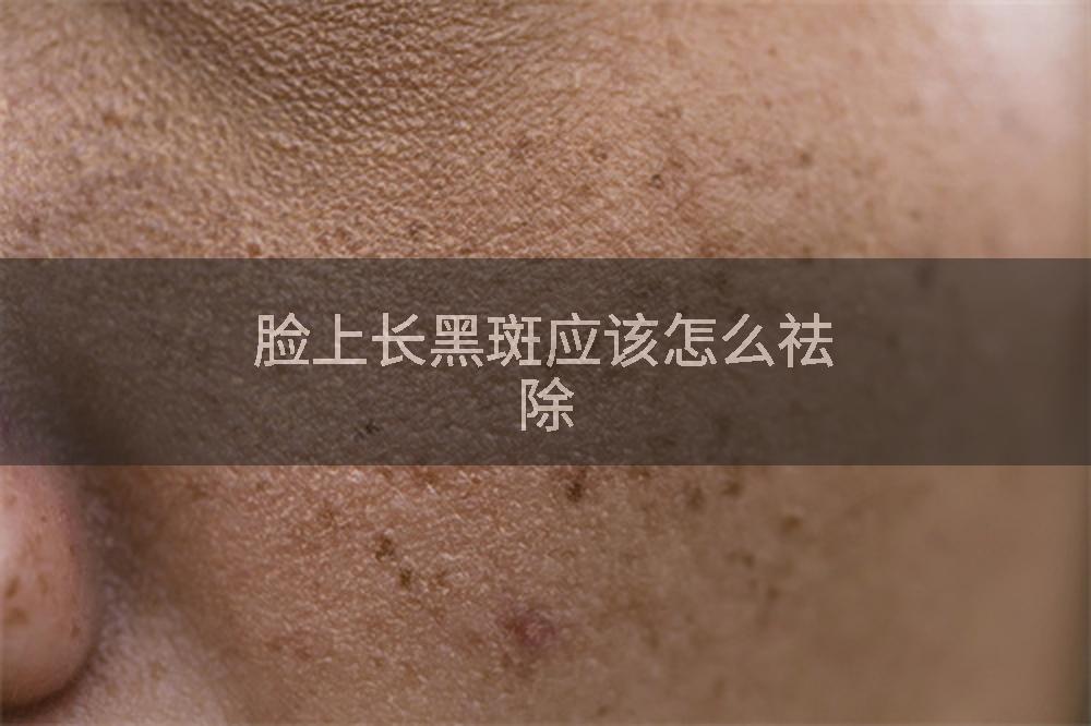 脸上长黑斑应该怎么祛除