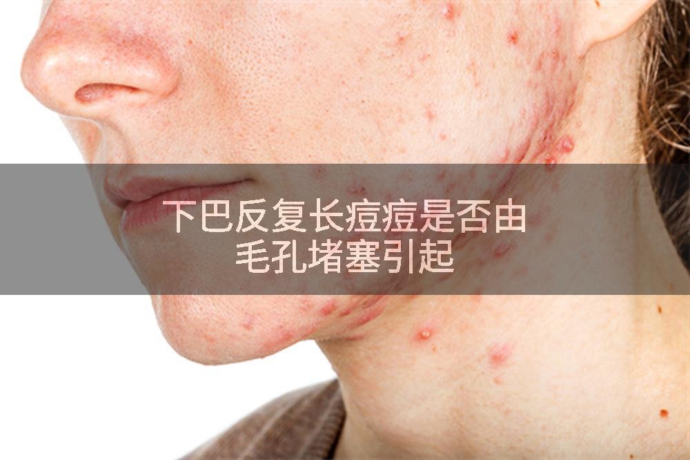 下巴反复长痘痘是否由毛孔堵塞引起