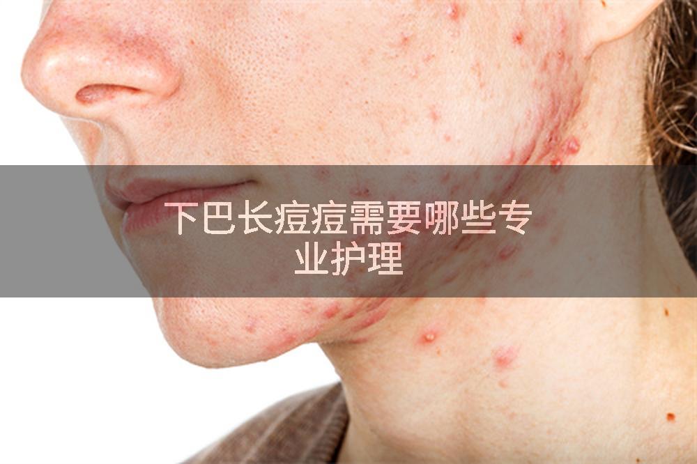 下巴长痘痘需要哪些专业护理