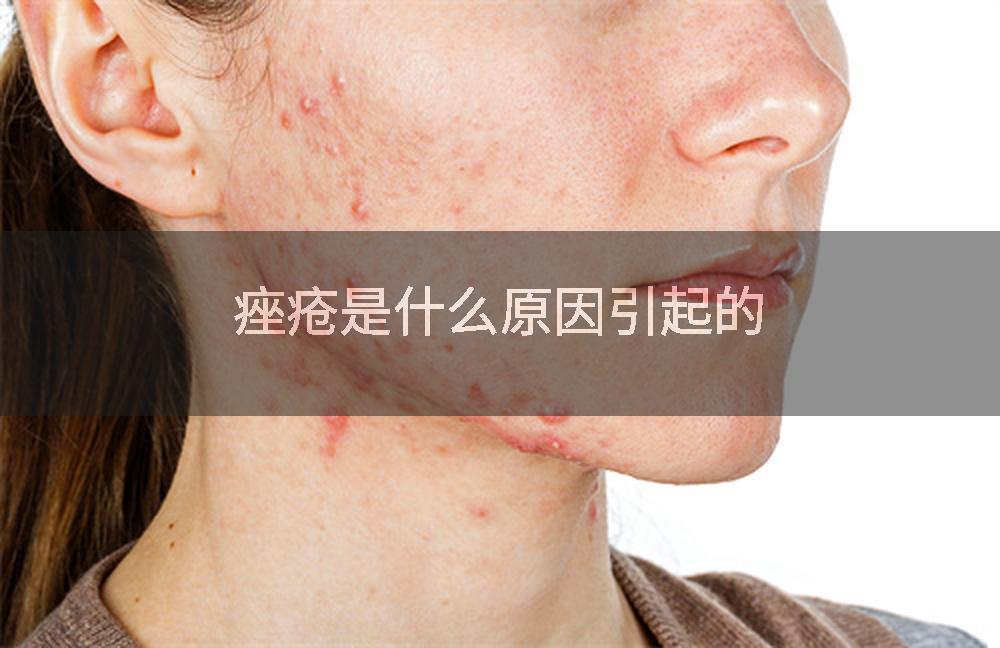 痤疮是什么原因引起的