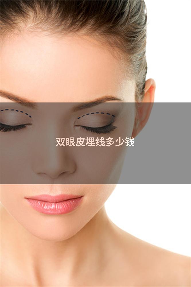 双眼皮埋线多少钱