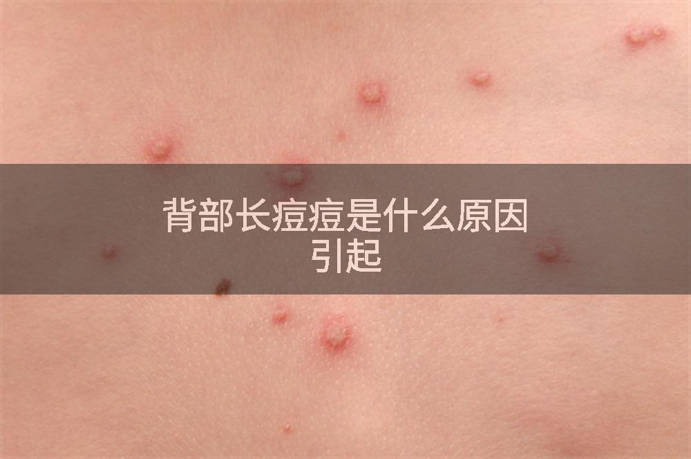 背部长痘痘是什么原因引起