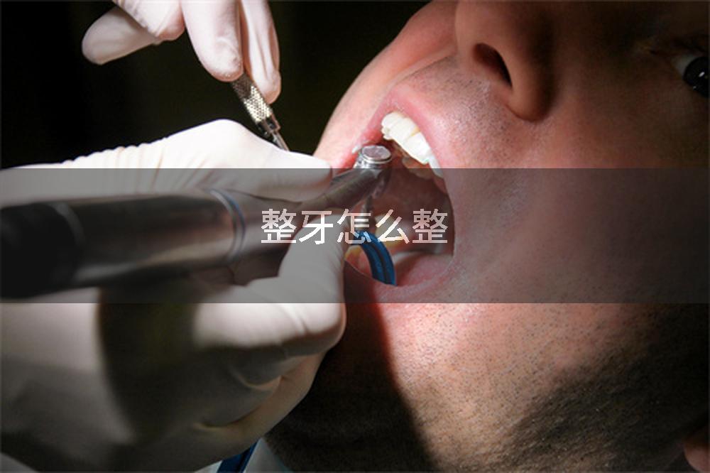 整牙怎么整