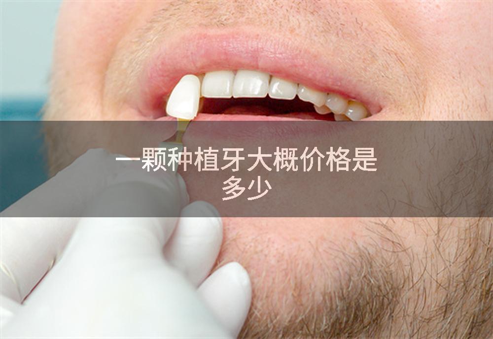 一颗种植牙大概价格是多少