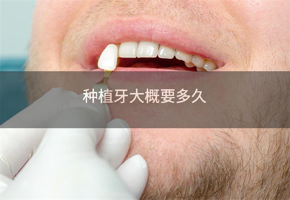 种植牙大概要多久