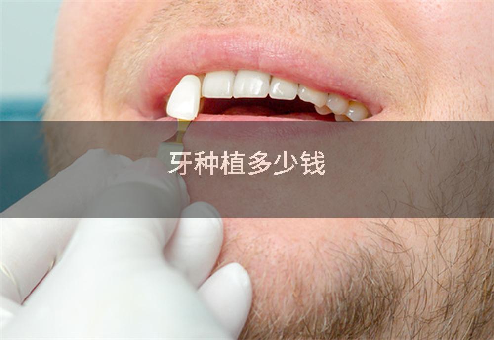 牙种植多少钱