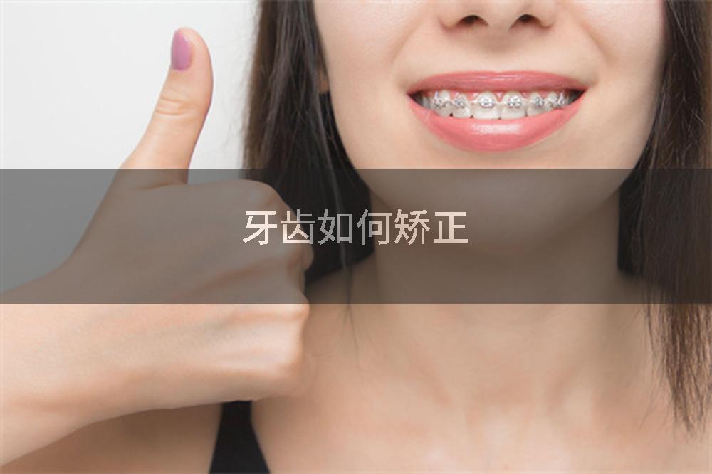 牙齿如何矫正