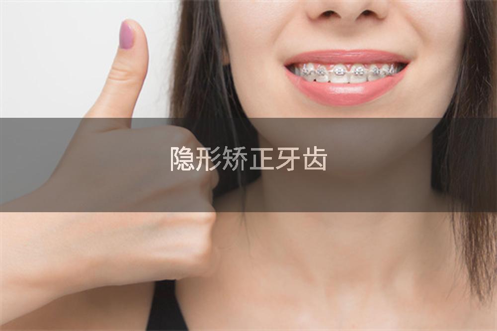 隐形矫正牙齿