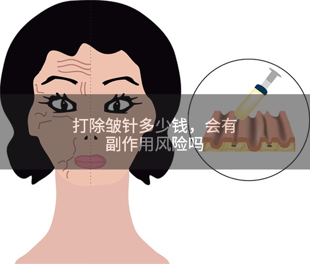 打除皱针多少钱，会有副作用风险吗