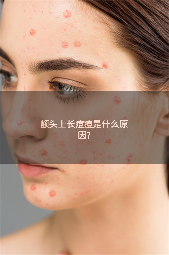额头上长痘痘是什么原因?