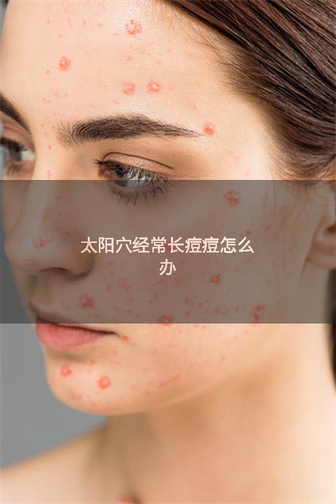 太阳穴经常长痘痘怎么办