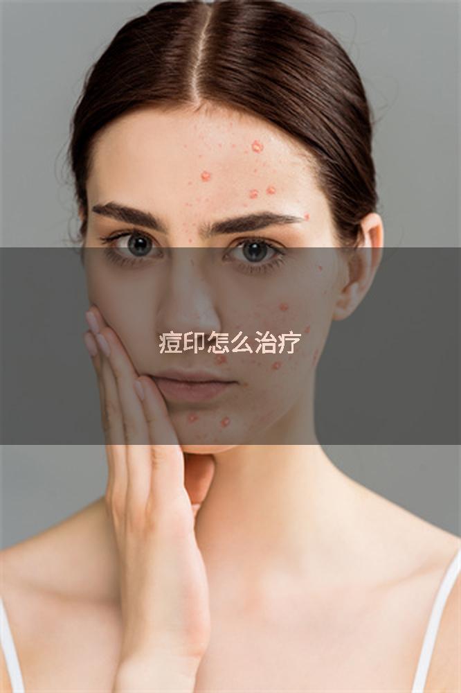 痘印怎么治疗